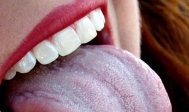 Adana'da iki mahalle "mavi dil" hastalığı nedeniyle karantinaya alındı