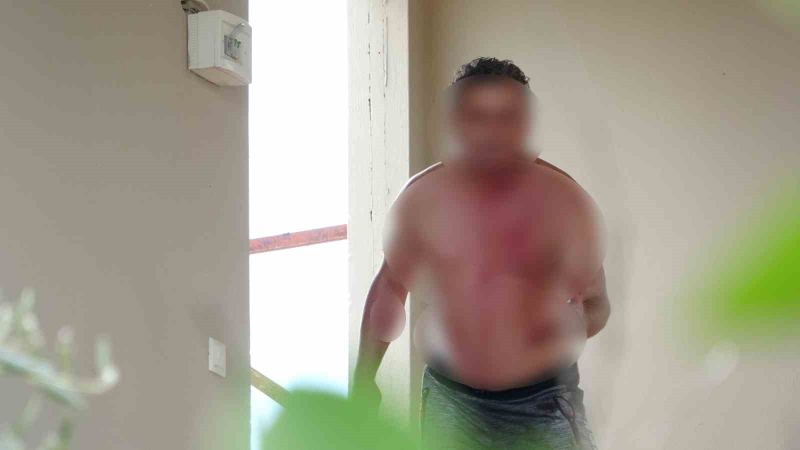 ANTALYA’NIN MANAVGAT İLÇESİNDE  OTELDE GÜVENLİK OLARAK ÇALIŞAN BİR ŞAHIS 3 KATLI OTEL LOJMANININ ÇATISINA ÇIKARAK ELİNDEKİ USTURA İLE VÜCUDUNA KESİKLER ATTI. AYRILDIĞI KARISI GELMEDEN AŞAĞIYA İNMEYECEĞİNİ SÖYLEYEN ŞAHIS 3 SAATLİK GÖRÜŞMENİN ARDINDAN İKNA EDİLDİ.
