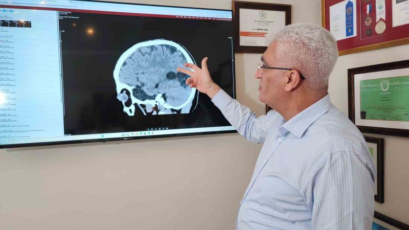 BEYİN, SİNİR VE OMURİLİK CERRAHİSİ PROF. DR. ORHAN ŞEN, İNME VAKALARINDAKİ ARTIŞTA PANDEMİ SONRASI DEĞİŞEN YAŞAM TARZININ DA SORGULANMASI GEREKTİĞİNİ BELİRTEREK, DÜZENLİ UYKU VE EGZERSİZİN ÖNEMİNE DİKKAT ÇEKTİ.