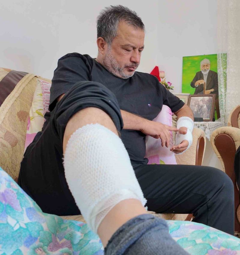 ŞÜKRÜ ERDOĞAN KÖPEK SALDIRISINDA YARALANDI