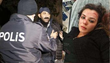 AYRILDIĞI EŞİNİ SOPAYLA DARP EDİP YÜZÜNÜ KESEN ZANLI TUTUKLANDI