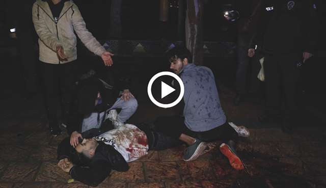 Köpek gezdiren kişi tarafından bıçaklanan genç ağır yaralandı